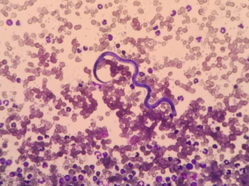 Parasitic worm found in a blood sample
